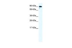 Glutamate Receptor 6 Antibody, Novus Biologicals 100 &mu;L | Buy Online | Novus Biologicals | Fisher Scientific